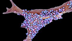 [:es]Are infections seeding some cases of Alzheimer’s disease?[:]