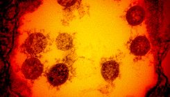 [:es] ¿Por qué el coronavirus se propaga ahora con tanta velocidad?[:]