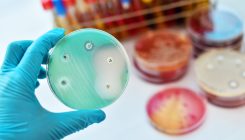 [:es] La resistencia bacteriana a los antibióticos se agrava por la covid-19[:]