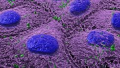[:es]Nanoplastikoek hesteetako mikrobioma eralda dezakete[:]