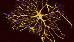 [:es]EHUko ikertzaileek frogatu dute astrozitoak gako direla Parkinsonaren garapenean[:]