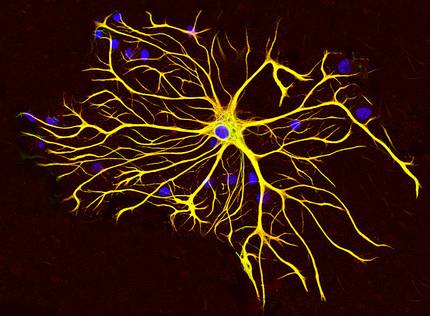 [:es]EHUko ikertzaileek frogatu dute astrozitoak gako direla Parkinsonaren garapenean[:]