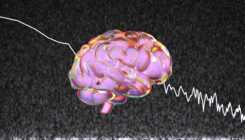 [:es]Brain’s ‘Background Noise’ May Hold Clues to Persistent Mysteries[:]