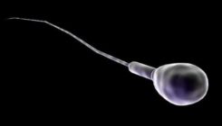 [:es] Gizonen antisorgailuak, beti gerorako [:]