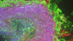 [:es]Reduced Adult Neurogenesis Linked with Alzheimer’s Disease[:]