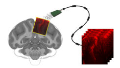 [:es]Ultrasound reads monkey brains, opening new way to control machines with thought[:]