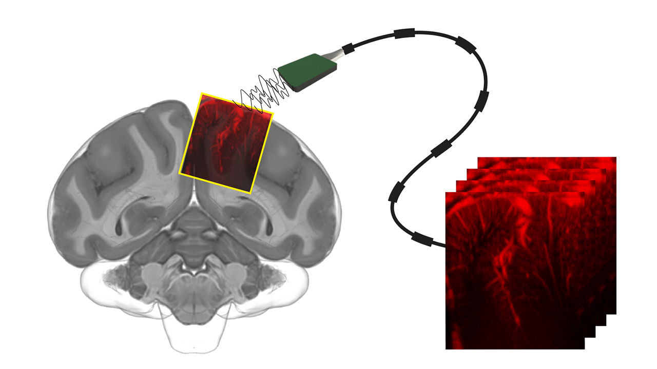 [:es]Ultrasound reads monkey brains, opening new way to control machines with thought[:]