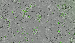 [:es]Bispecific Antibodies Treat Cancer in Mouse Models[:]