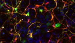 [:es]Transforman por primera vez astrocitos en neuronas para reparar circuitos visuales[:]