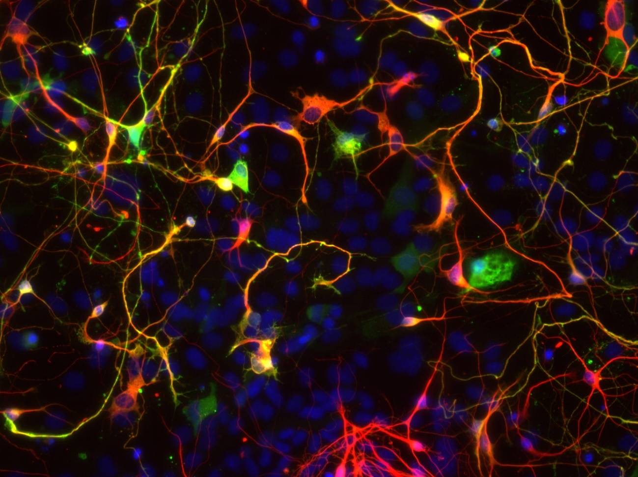 [:es]Transforman por primera vez astrocitos en neuronas para reparar circuitos visuales[:]