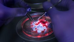 [:es]Elusive cancer cells dissected using developmental-biology toolkit[:]
