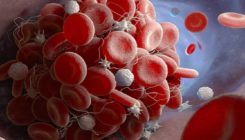 [:es]Baliteke erantzun autoimmune bat izatea Astrazenecaren txertoaren ondorengoko gertakari tronbotikoen arrazoia[:]
