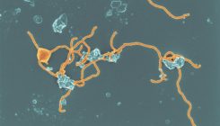 [:es]The mysterious microbes that gave rise to complex life[:]