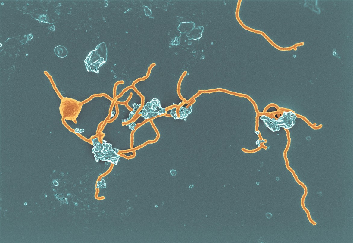 [:es]The mysterious microbes that gave rise to complex life[:]