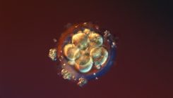 [:es]Limit on lab-grown human embryos dropped by stem-cell body[:]