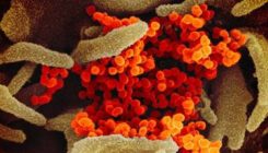 [:es]Aurrerapausoak antibiral bat lortzeko bidean[:]