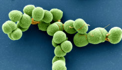 [:es]Plasmid, Virus or Other? DNA ‘Borgs’ Blur Boundaries.[:]