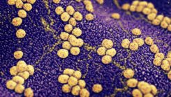 [:es]Así actúa la penicilina en la pared celular de una superbacteria resistente[:]