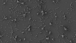 [:es]Una ‘píldora viva’ para tratar infecciones resistentes a los antibióticos[:]