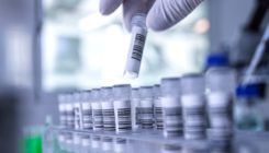 [:es]High-profile autism genetics project paused amid backlash[:]