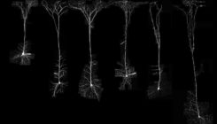 [:es] Descubren que las neuronas humanas son más eficientes que las de otros mamíferos [:]