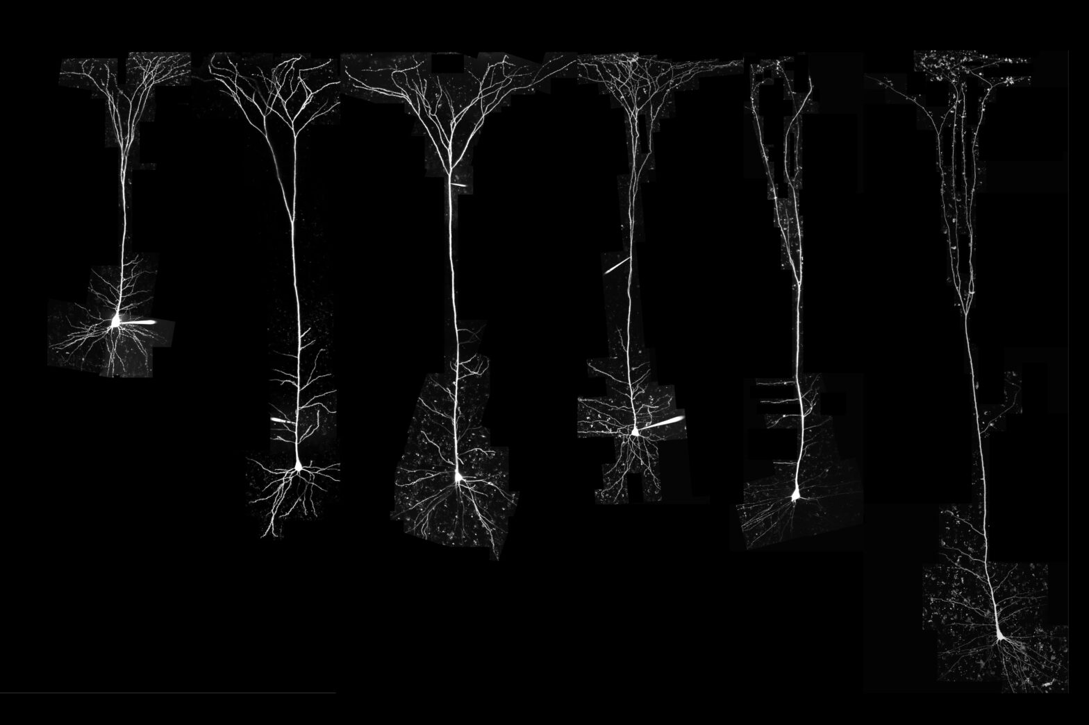 [:es] Descubren que las neuronas humanas son más eficientes que las de otros mamíferos [:]