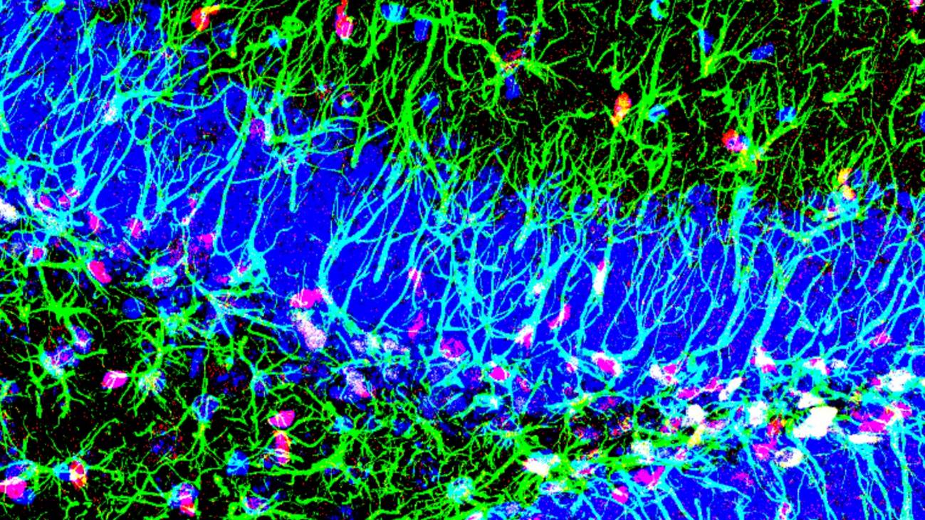 [:es]Descubierto un nuevo mecanismo para activar las células madre del cerebro adulto[:]