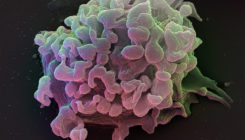 [:es]New class of killer T cells may prevent autoimmune diseases[:]