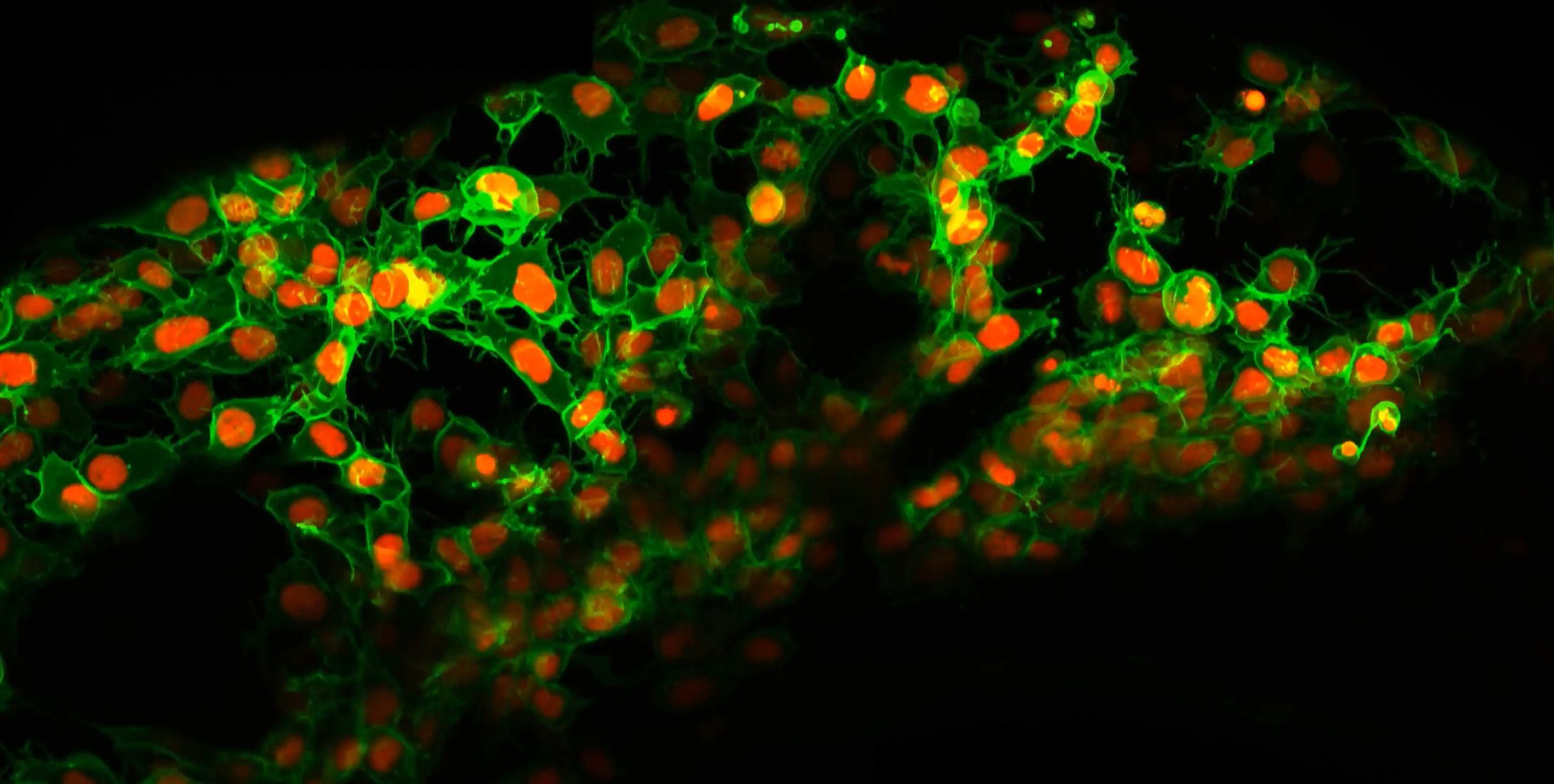 [:es]Cells Blaze Their Own Trails to Navigate Through the Body[:]