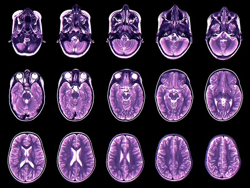 [:es]Your brain expands and shrinks over time — these charts show how[:]