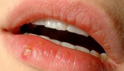 [:es]Herpesbirus latentea nola berraktibatzen den argitu dute[:]