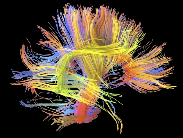 ‘Wiring diagrams’ link lifestyle to brain function