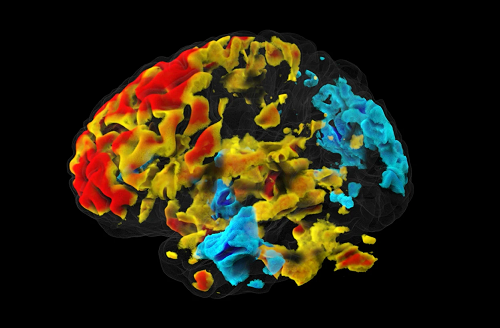 This fMRI technique promised to transform brain research — why can no one replicate it?
