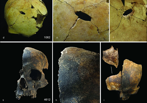 Violencia extrema, desmembramientos, canibalismo… Así fue la peor matanza prehistórica de Gran Bretaña hace 4.000 años