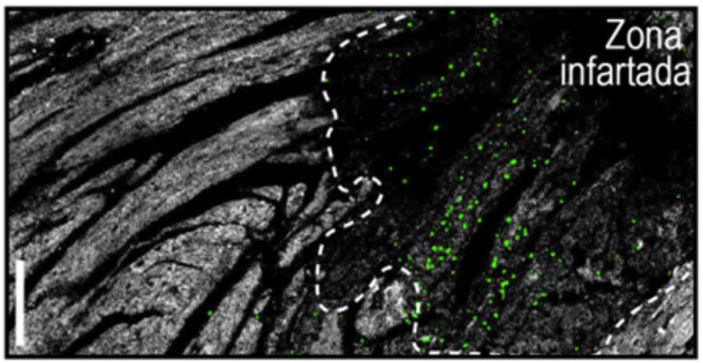 Los neutrófilos son menos agresivos por la noche, lo que reduce el daño de los infartos nocturnos