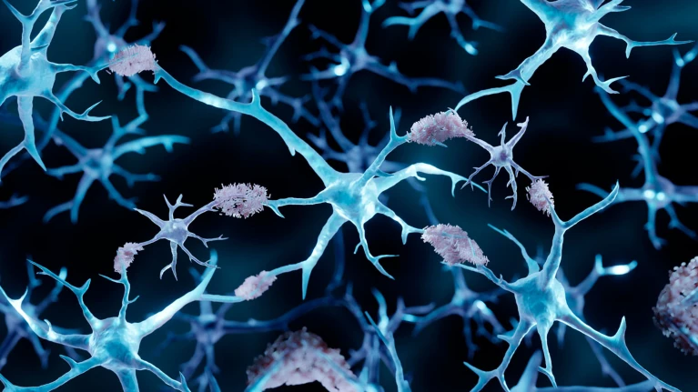 Cancer might protect against Alzheimer’s — this protein helps explain why